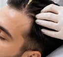 Hair Restoration at Paradise Wellness