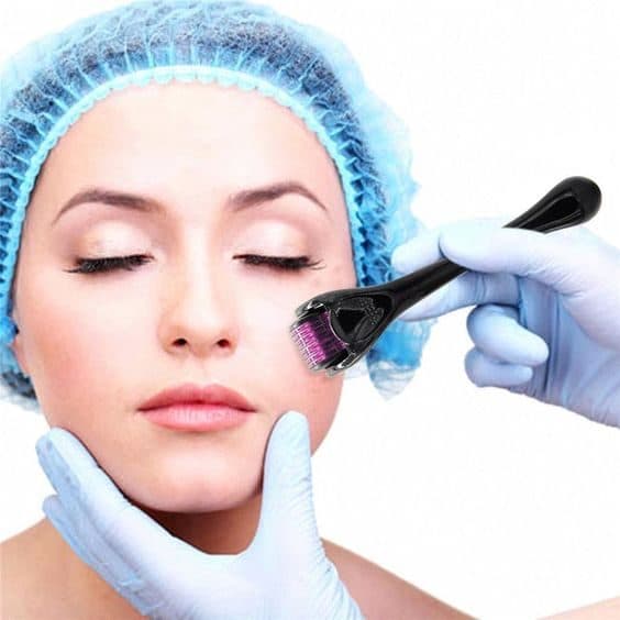 Gloved hands using a microneedling roller on the cheek of a woman wearing a hair cap