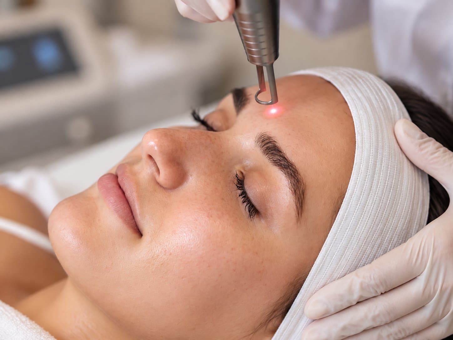 Face Laser Toning Image